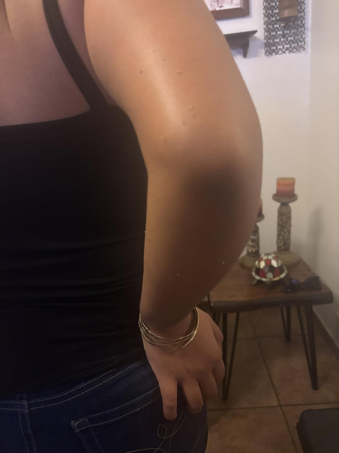 Elbows finally look clean, not patchy