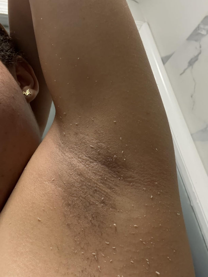 It feels like I have a new skin and its wonderful!!!