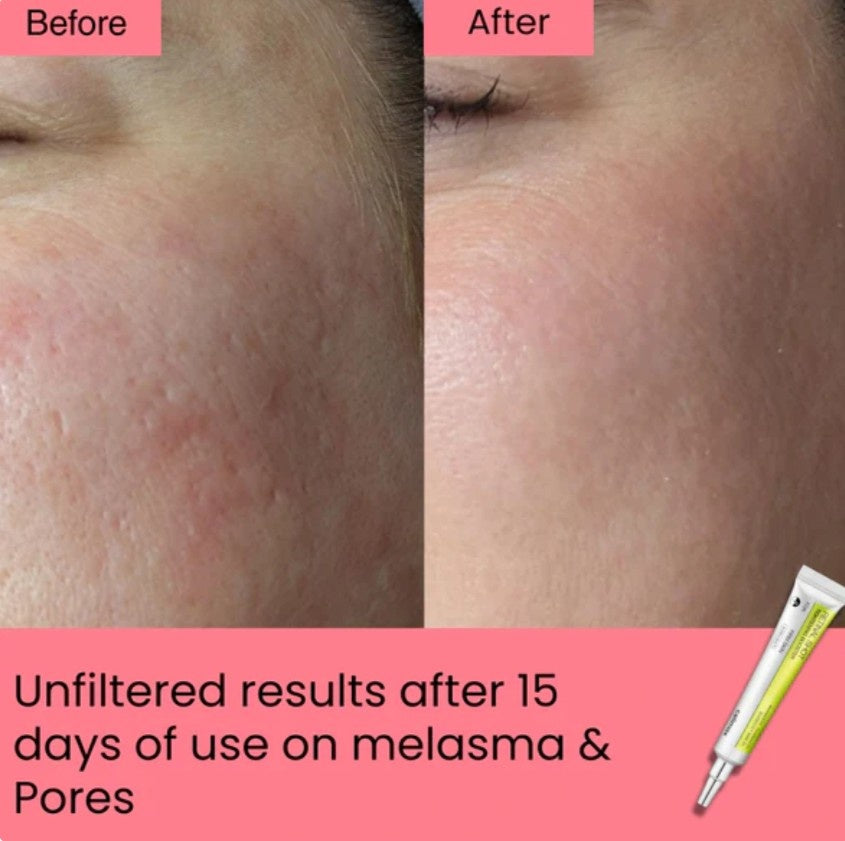 Celimax Retinal Shot Tightening Booster